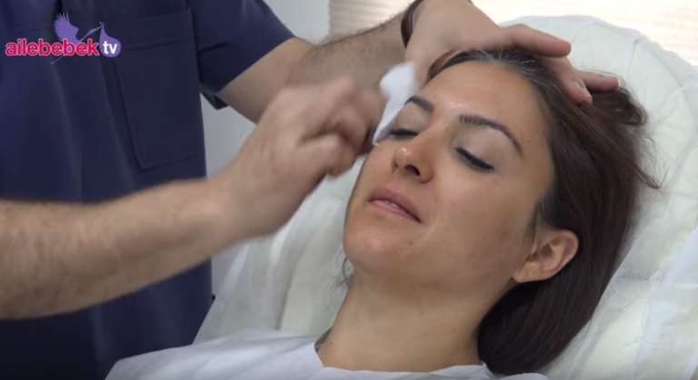 Karbon peeling cildi gençleştirir mi?